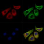 CD1a Antibody in Immunocytochemistry (ICC/IF)