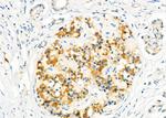 CD26 Antibody in Immunohistochemistry (Paraffin) (IHC (P))