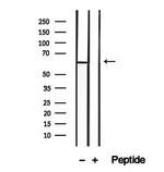 CD26 Antibody in Western Blot (WB)