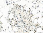 CD44 Antibody in Immunohistochemistry (Paraffin) (IHC (P))