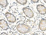 CD44 Antibody in Immunohistochemistry (Paraffin) (IHC (P))