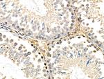 CDK8 Antibody in Immunohistochemistry (Paraffin) (IHC (P))