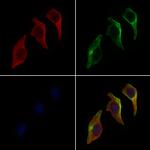 CEL Antibody in Immunocytochemistry (ICC/IF)