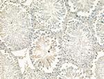 CHD4 Antibody in Immunohistochemistry (Paraffin) (IHC (P))