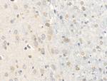 Chordin Antibody in Immunohistochemistry (Paraffin) (IHC (P))