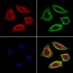 Chromogranin C Antibody in Immunocytochemistry (ICC/IF)