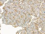 Clathrin Heavy Chain Antibody in Immunohistochemistry (Paraffin) (IHC (P))