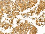 Clathrin Heavy Chain Antibody in Immunohistochemistry (Paraffin) (IHC (P))