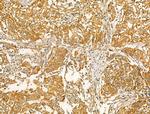 Clathrin Heavy Chain Antibody in Immunohistochemistry (Paraffin) (IHC (P))