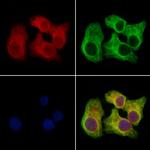 Clathrin Heavy Chain Antibody in Immunocytochemistry (ICC/IF)