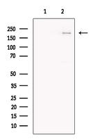 Clathrin Heavy Chain Antibody in Western Blot (WB)