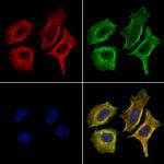 CERT Antibody in Immunocytochemistry (ICC/IF)