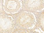 CERT Antibody in Immunohistochemistry (Paraffin) (IHC (P))