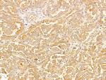 CERT Antibody in Immunohistochemistry (Paraffin) (IHC (P))