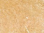 CERT Antibody in Immunohistochemistry (Paraffin) (IHC (P))