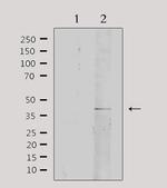 Collagen IV Antibody in Western Blot (WB)