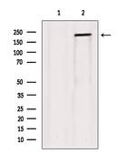 Collagen V Antibody in Western Blot (WB)