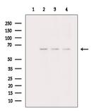 Collagen X Antibody in Western Blot (WB)