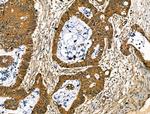 Collagen X Antibody in Immunohistochemistry (Paraffin) (IHC (P))