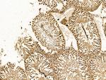 RCOR1 Antibody in Immunohistochemistry (Paraffin) (IHC (P))