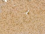 RCOR1 Antibody in Immunohistochemistry (Paraffin) (IHC (P))