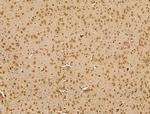 RCOR1 Antibody in Immunohistochemistry (Paraffin) (IHC (P))