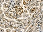 RCOR1 Antibody in Immunohistochemistry (Paraffin) (IHC (P))