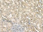 RCOR1 Antibody in Immunohistochemistry (Paraffin) (IHC (P))