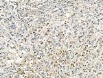 RCOR1 Antibody in Immunohistochemistry (Paraffin) (IHC (P))