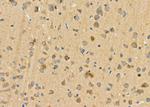 CRABP2 Antibody in Immunohistochemistry (Paraffin) (IHC (P))