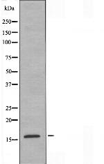 CRABP2 Antibody in Western Blot (WB)