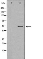 CD116 Antibody in Western Blot (WB)