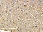 CSF2RB Antibody in Immunohistochemistry (Paraffin) (IHC (P))