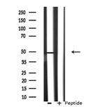 CSTF1 Antibody in Western Blot (WB)