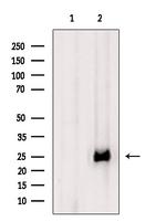 CTLA-4 Antibody in Western Blot (WB)