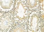 CXCL5 Antibody in Immunohistochemistry (Paraffin) (IHC (P))