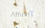 Cyclin D1 Antibody in Immunohistochemistry (Paraffin) (IHC (P))