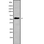 CYP26A1 Antibody in Western Blot (WB)