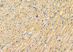 MTCO1 Antibody in Immunohistochemistry (Paraffin) (IHC (P))