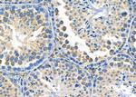 MTCO1 Antibody in Immunohistochemistry (Paraffin) (IHC (P))