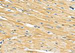 MTCO1 Antibody in Immunohistochemistry (Paraffin) (IHC (P))