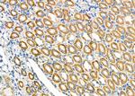 MTCO1 Antibody in Immunohistochemistry (Paraffin) (IHC (P))