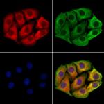 DYNC1I1 Antibody in Immunocytochemistry (ICC/IF)