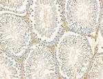 DYNC1I1 Antibody in Immunohistochemistry (Paraffin) (IHC (P))