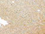 DYNC1I1 Antibody in Immunohistochemistry (Paraffin) (IHC (P))