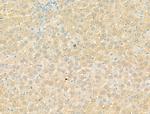 DYNC1I1 Antibody in Immunohistochemistry (Paraffin) (IHC (P))