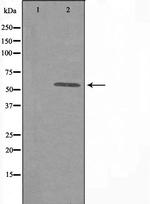 DAK Antibody in Western Blot (WB)