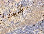 DCP2 Antibody in Immunohistochemistry (Paraffin) (IHC (P))