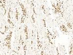 DCP2 Antibody in Immunohistochemistry (Paraffin) (IHC (P))