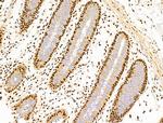 DCP2 Antibody in Immunohistochemistry (Paraffin) (IHC (P))